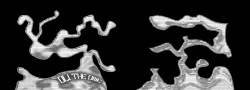 OLITHEONE_Cubentacol